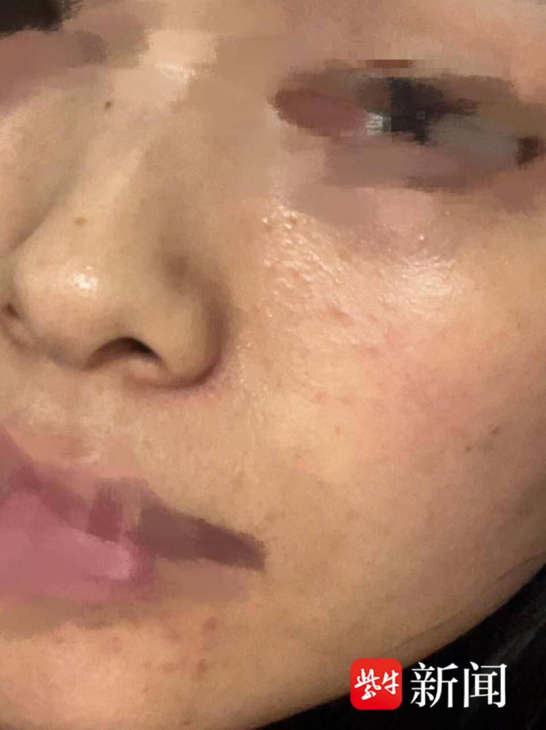 【3·15維權直通車】“閨蜜局”還是美麗陷阱？泗陽一“店中店”美容會所致顧客難維權